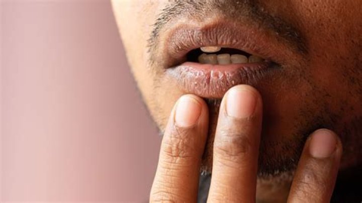 ドライマウスが治った？知恵袋の体験談と本当に効く改善法を徹底解説